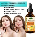 ROUSHUN Hydrating and Whitening Honey Lemon Serum