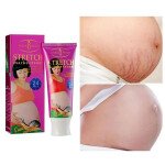 Stretch Marks Cream in Pakistan