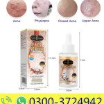 Aichun Beauty Moisturizing Brightening and Anti Acne Rice Face Serum