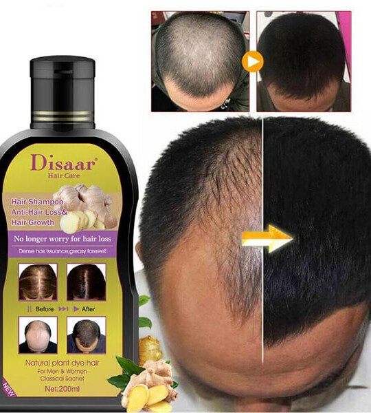 Disaar AntiHair Loss & Hair Growth Shampoo Price in Pakistan 0300