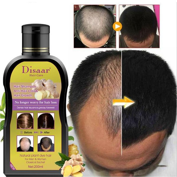 Disaar Anti-Hair Loss & Hair Growth Shampoo Price in Pakistan | 0300 ...