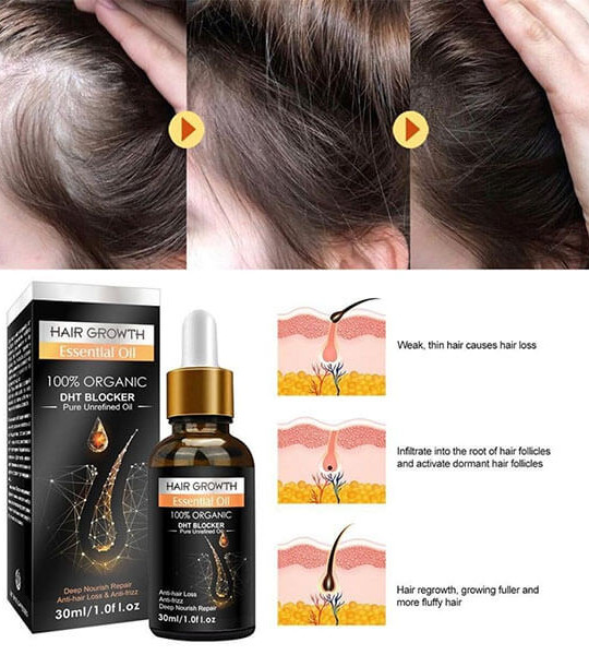 Hair Growth Essential Oil Biotin Cold-Pressed DHT Blocker